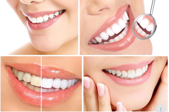 牙齿美白的方法有哪些 最有效的四种牙齿美白方法