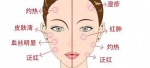 敏感肌脸上红血丝护肤方法注意事项